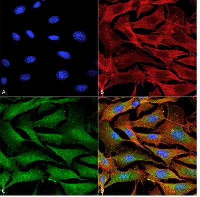 Immunocytochemistry/ Immunofluorescence: ATP7A Antibody (S60-4) [NBP2-59376]
