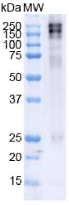 Western Blot: ATP7A Antibody (S60-4) [NBP2-59376]