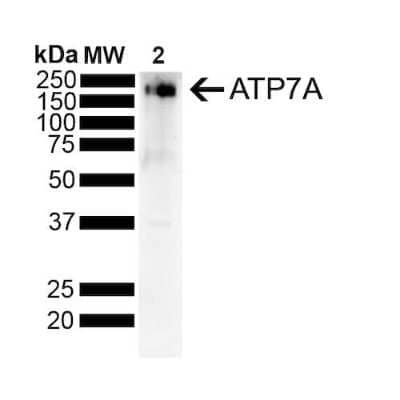 Western Blot: ATP7A Antibody (S60-4) [NBP2-59376]