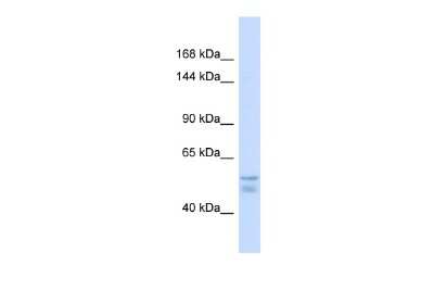 Western Blot: ATP7A Antibody [NBP3-10578]