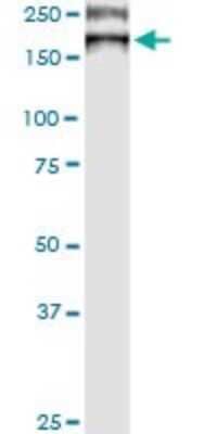 Western Blot: ATP7b Antibody (3E10) [H00000540-M01]