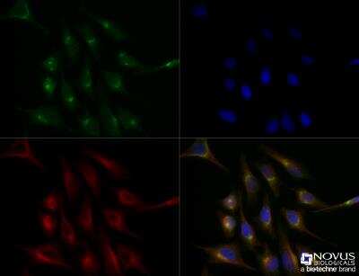 Immunocytochemistry/ Immunofluorescence: ATP7b Antibody - BSA Free [NB100-360]