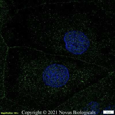 Immunocytochemistry/ Immunofluorescence: ATP7b Antibody [NB100-361]