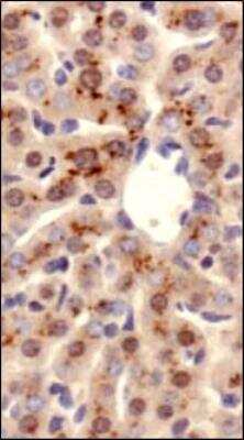 Immunohistochemistry: ATP7b Antibody - BSA Free [NB100-360]
