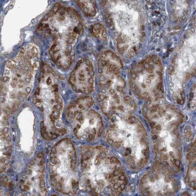 Immunohistochemistry-Paraffin: ATP7b Antibody [NBP2-48523]