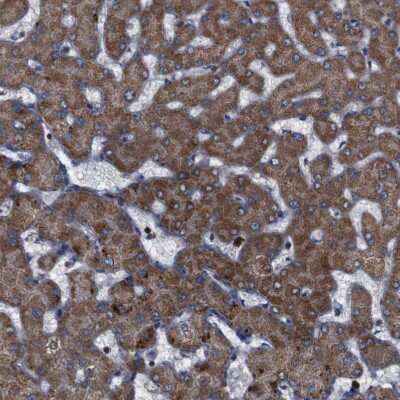 Immunohistochemistry-Paraffin: ATP7b Antibody [NBP2-48523]