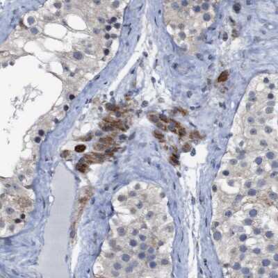 Immunohistochemistry-Paraffin: ATP7b Antibody [NBP2-48523]