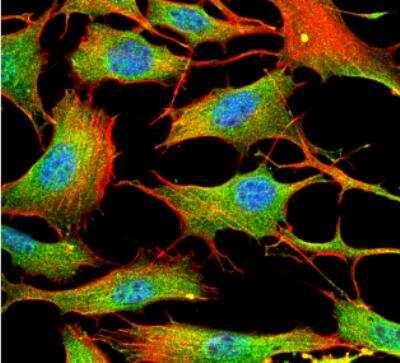 Immunocytochemistry/ Immunofluorescence: ATP7b Antibody (S62-29) [NBP2-59375]