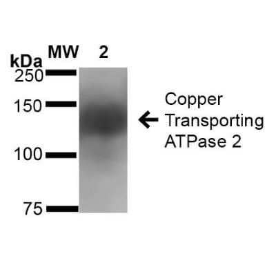 Western Blot: ATP7b Antibody (S62-29) [NBP2-59375]