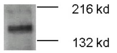 Western Blot: ATP7b AntibodyBSA Free [NB100-360]