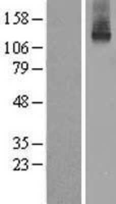 Western Blot: ATP7b Overexpression Lysate [NBL1-07848]