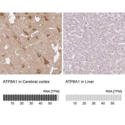 Immunohistochemistry-Paraffin: ATP8A1 Antibody [NBP2-30403]