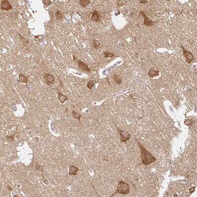 Immunohistochemistry-Paraffin: ATP8A1 Antibody [NBP2-30403]