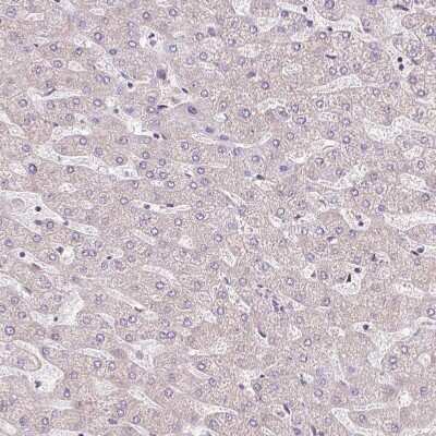 Immunohistochemistry-Paraffin: ATP8A1 Antibody [NBP2-30403]