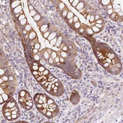 Immunohistochemistry-Paraffin: ATP8A1 Antibody [NBP2-30403]
