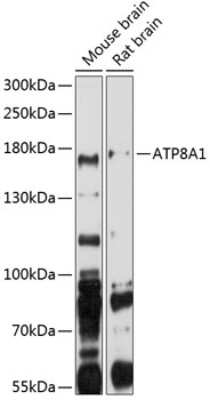 Western Blot: ATP8A1 AntibodyBSA Free [NBP2-92425]