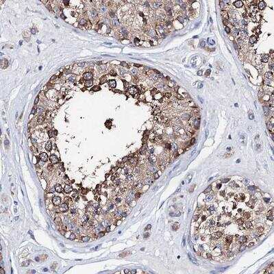 Immunohistochemistry-Paraffin: ATP8A2 Antibody [NBP1-88899]