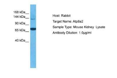 Western Blot: ATP8A2 Antibody [NBP2-84485]