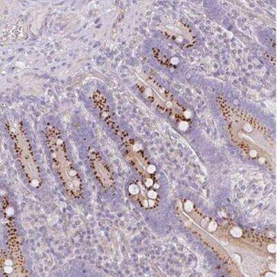 Immunohistochemistry: ATP8B2 Antibody [NBP2-30486]