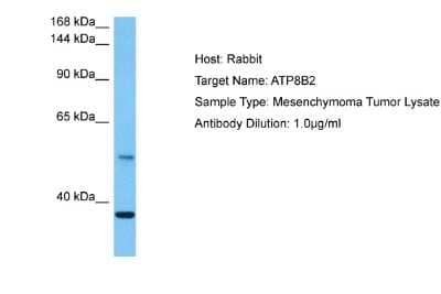 Western Blot: ATP8B2 Antibody [NBP2-87057]