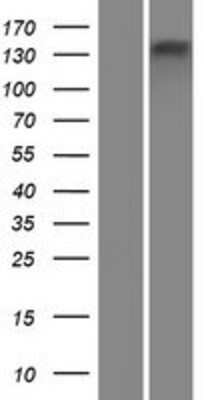 Western Blot: ATP8B4 Overexpression Lysate [NBP2-06262]