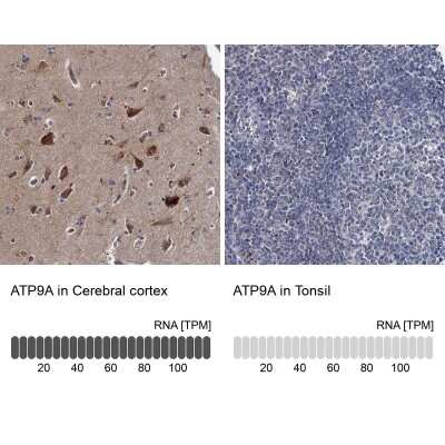 Immunohistochemistry-Paraffin: ATP9A Antibody [NBP1-88905]