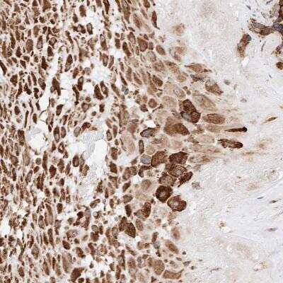 Immunohistochemistry: ATP9B Antibody [NBP1-88906]