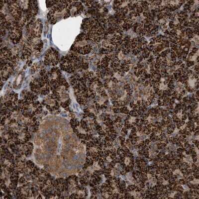Immunohistochemistry-Paraffin: ATPAF2 Antibody [NBP1-88885]