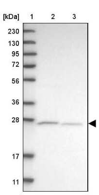 Western Blot: ATPAF2 Antibody [NBP1-88885]