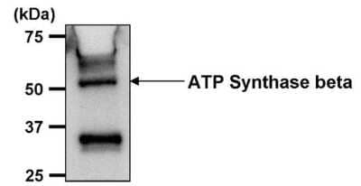 Immunoprecipitation: ATPB Antibody (4.3E8.D10) [NB600-1171]