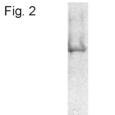 Immunoprecipitation: ATPB Antibody (4.3E8.D10) [NB600-1171]