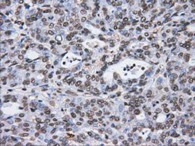 Immunohistochemistry-Paraffin: ATPB Antibody (OTI4E5) [NBP2-02249]