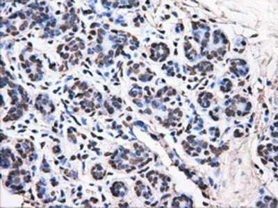 Immunohistochemistry-Paraffin: ATPB Antibody (OTI4E5) [NBP2-02249]