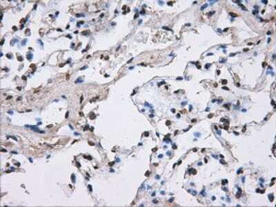 Immunohistochemistry-Paraffin: ATPB Antibody (OTI4E5) [NBP2-02249]