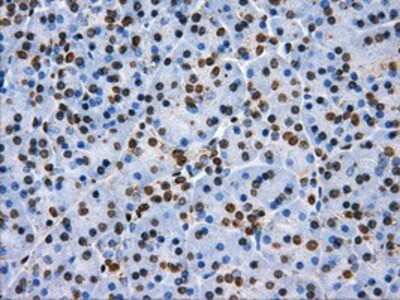 Immunohistochemistry-Paraffin: ATPB Antibody (OTI4E5) [NBP2-02249]