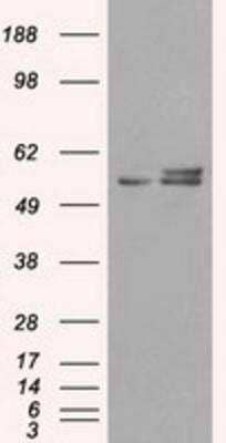 Western Blot: ATPB Antibody (OTI4E5) [NBP2-02249]