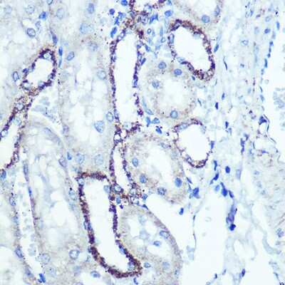 Immunohistochemistry-Paraffin: ATPB Antibody (1H2W2) [NBP3-15354]