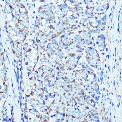 Immunohistochemistry-Paraffin: ATPB Antibody (1H2W2) [NBP3-15354]