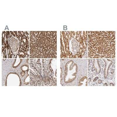 Immunohistochemistry-Paraffin: ATPB Antibody [NBP1-90815]