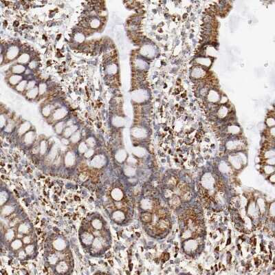 Immunohistochemistry-Paraffin: ATPB Antibody [NBP1-90815]