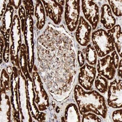 Immunohistochemistry-Paraffin: ATPB Antibody [NBP1-90815]