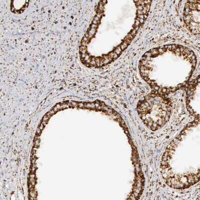 Immunohistochemistry-Paraffin: ATPB Antibody [NBP1-90815]