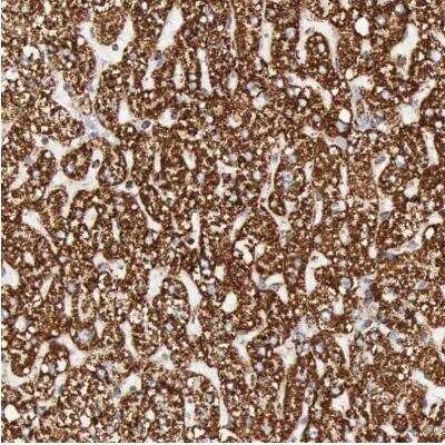 Immunohistochemistry-Paraffin: ATPB Antibody [NBP1-90815]