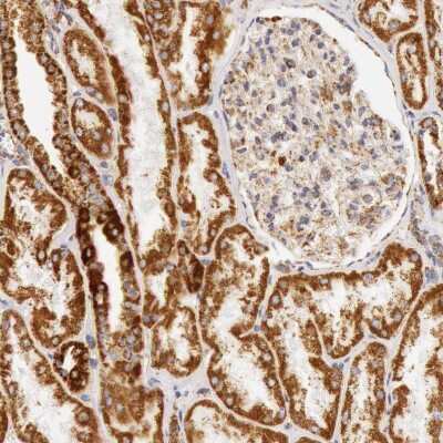 Immunohistochemistry-Paraffin: ATPB Antibody [NBP1-90816]