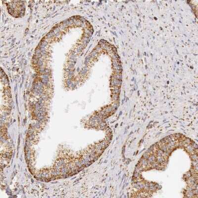 Immunohistochemistry-Paraffin: ATPB Antibody [NBP1-90816]