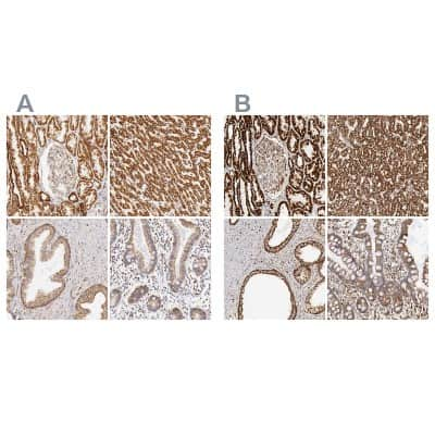 Immunohistochemistry-Paraffin: ATPB Antibody [NBP1-90816]