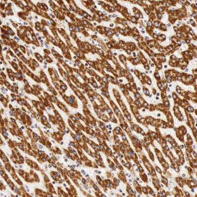 Immunohistochemistry-Paraffin: ATPB Antibody [NBP1-90816]