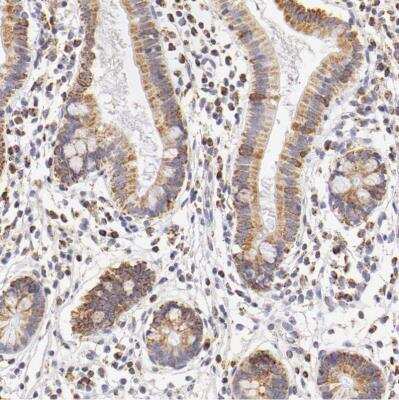 Immunohistochemistry-Paraffin: ATPB Antibody [NBP1-90816]