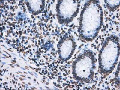 Immunohistochemistry: ATPB Antibody (OTI4E5) - Azide and BSA Free [NBP2-70224]