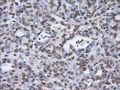 Immunohistochemistry: ATPB Antibody (OTI4E5) - Azide and BSA Free [NBP2-70224]